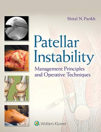 Patellar instability : management principles and operative techniques 1st Edition