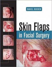 Skin flaps in facial surgery,