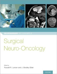 Surgical neuro-oncology