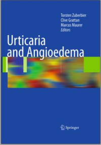 Urticaria and Angioedema/Torsten Zuberbier
